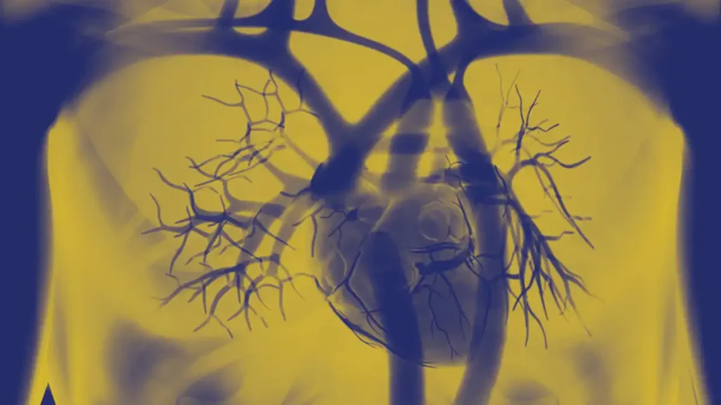 Heart-health-and-treatment-options-for-older-patients